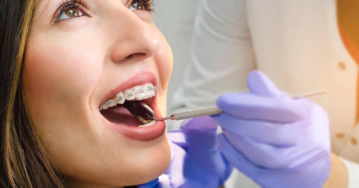trattamenti ortodontici adulti